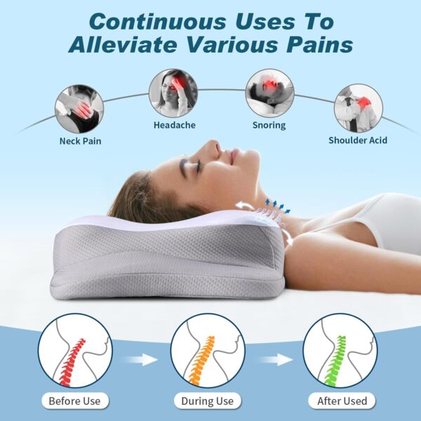 Cervical Neck Pillow for Pain Relief - Cooling Ergonomic Neck Support Pillow for Sleeping, Orthopedic Contour Memory Foam Pillows for Side, Back & Stomach Sleepers with Pillowcase (White) - Image 6