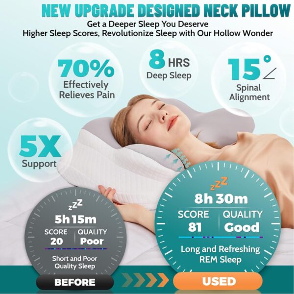 Neck Pillow for Sleeping, Cervical Neck Support Pillow for Neck and Shoulder Pain Relief, Memory Foam Side Sleeper Pillows for Adults, Ergonomic Contour Neck Pillow for Side Back Stomach Sleeper - Image 3