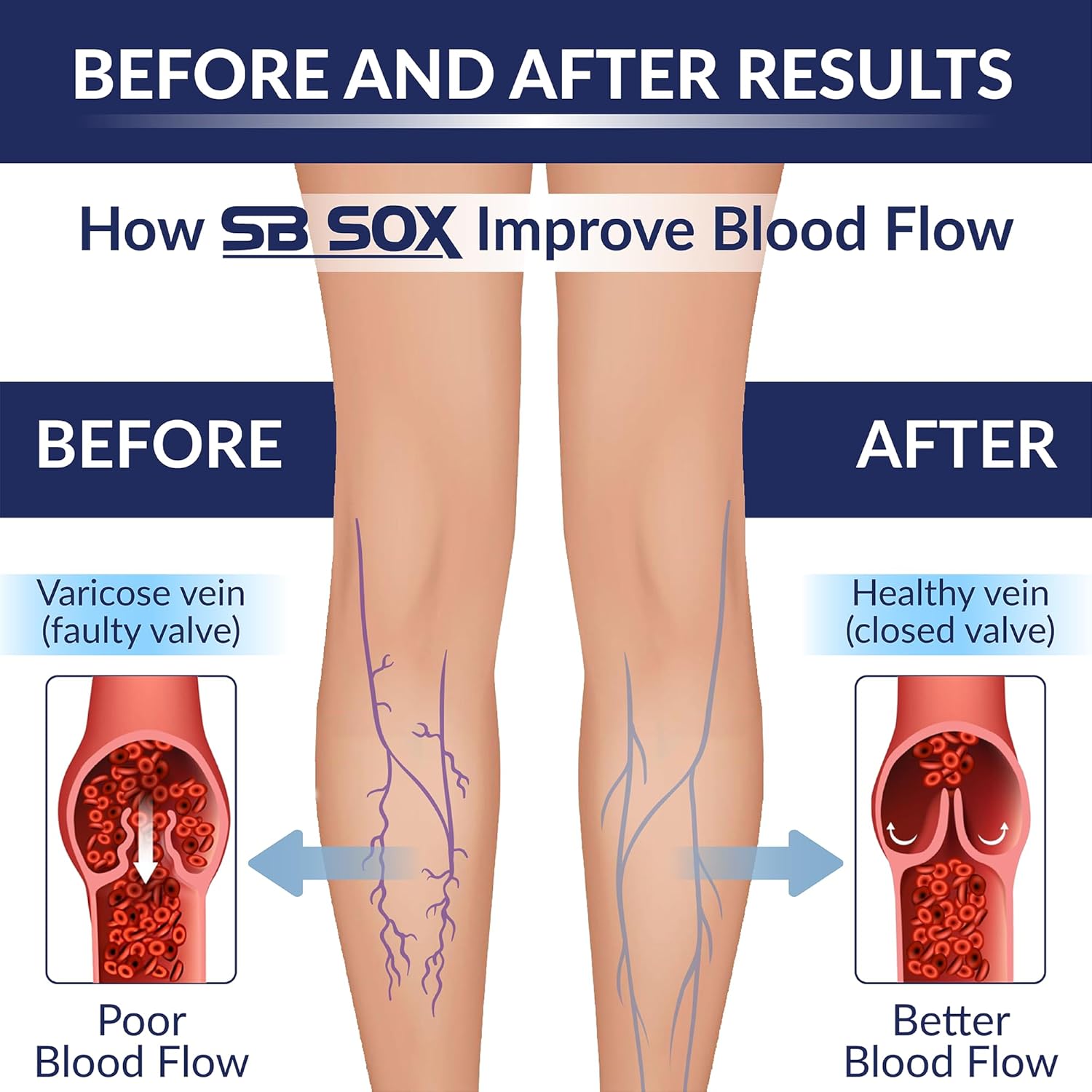 SB SOX Compression Socks for Men & Women (20-30 mmHg) - Best Support Stockings for Travel, Medical, and Sports - Perfect for Everyday Wear - Image 4